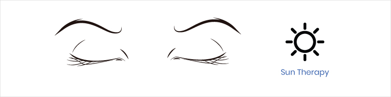 eye exercise sun therapy